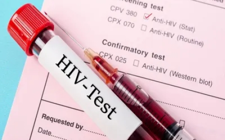 Zimbabwe records increase in AIDS-related deaths: minister