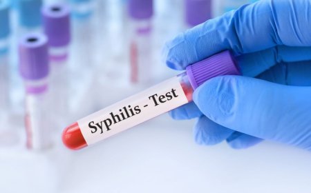 Rwanda plans to roll out rapid tests for congenital syphilis