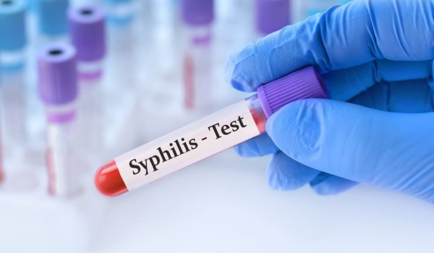 Rwanda plans to roll out rapid tests for congenital syphilis