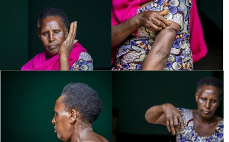 ‘Killed twice’: A Bigogwe survivor’s story of loss and resilience