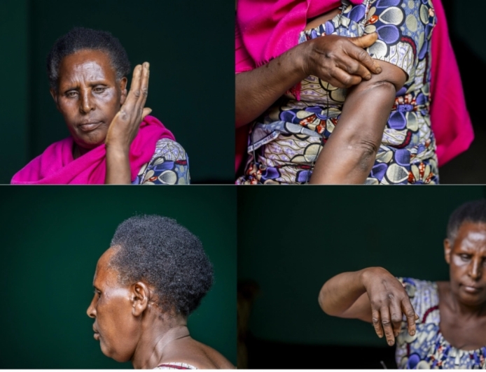 ‘Killed twice’: A Bigogwe survivor’s story of loss and resilience