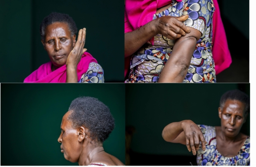 ‘Killed twice’: A Bigogwe survivor’s story of loss and resilience